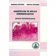Acantoliza in bolile dermatologice (Mariana Costache, Daniela Ciochina)