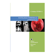 Patologia tumorala etmoidala. Strategii actuale in diagnostic si tratament - Cristina Stoica