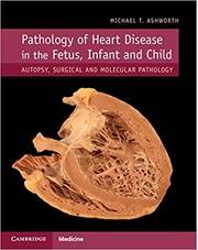 Pathology of Heart Disease in the Fetus, Infant and Child: Autopsy, Surgical and Molecular Pathology - Michael T. Ashworth
