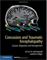 Concussion and Traumatic Encephalopathy: Causes, Diagnosis and Management - Jeff Victoroff, Erin D. Bigler