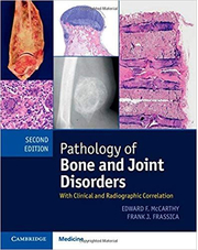Pathology of Bone and Joint Disorders Print and Online Bundle: With Clinical and Radiographic Correlation - Edward F. McCarthy, Frank J. Frassica