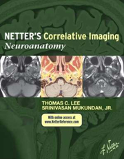 Netter's Correlative Imaging. Neuroanatomy - Thomas C. Lee, Srinivasan Mukundan