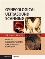 Gynaecological Ultrasound Scanning: Tips and Tricks - Kanna Jayaprakasan, Lukasz Polanski, Kamal Ojha