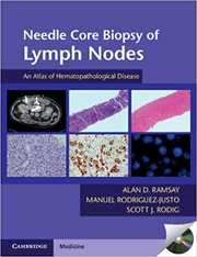 Needle Core Biopsy of Lymph Nodes with DVD-ROM: An Atlas of Hematopathological Disease - Alan D. Ramsay, Manuel Rodriguez-Justo, Scott J. Rodig