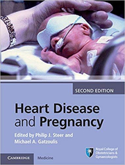 Heart Disease and Pregnancy - Philip J. Steer, Michael A. Gatzoulis