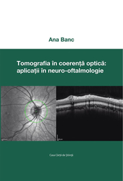 Tomografia in coerenta optica: aplicatii in neuro-oftalmologie - Ana Banc