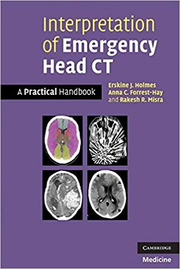 Interpretation of Emergency Head CT: A Practical Handbook - Erskine J. Holmes, Anna C. Forrest-Hay, Dr Rakesh R. Misra