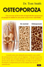 Osteoporoza - Dr. Tom Smith