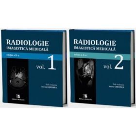 Radiologie-Imagistica medicala. Volumele 1-2 - Ioana-Andreea Gheonea