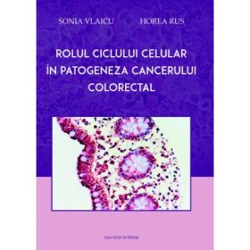 Rolul ciclului celular in patogeneza cancerului colorectal - Sonia Vlaicu, Horea Rus