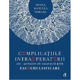 Complicatiile intraoperatorii ale operatiei de cataracta prin facoemulsificare - Dr. Ozana Moraru