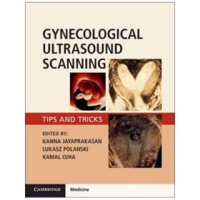 Gynaecological Ultrasound Scanning: Tips and Tricks - Kanna Jayaprakasan, Lukasz Polanski, Kamal Ojha