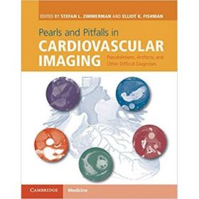 Pearls and Pitfalls in Cardiovascular Imaging: Pseudolesions, Artifacts, and Other Difficult Diagnoses - Stefan L. Zimmerman, Elliot K. Fishman