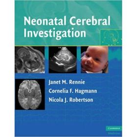 Neonatal Cerebral Investigation - Janet M. Rennie, Cornelia F. Hagmann, Nicola J. Robertson