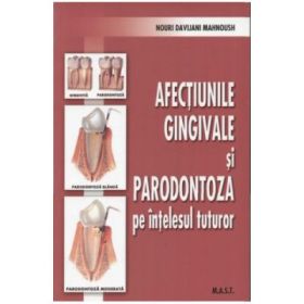 Afectiunile gingivale si paradontoza pe intelesul tuturor - Nouri Davijani Mahnoush