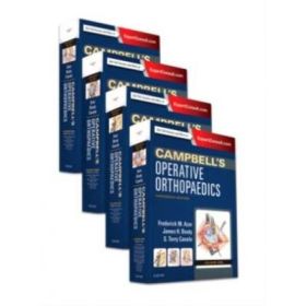 Campbell's Operative Orthopaedics, 4-Volume Set: Campbell Ortopedie - Frederick M Azar