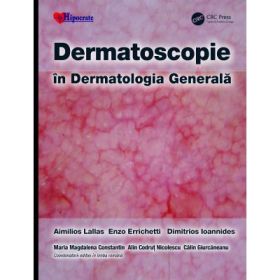 Dermatoscopie in Dermatologia Generala - Aimilios Lallas, Enzo Errichetti, Dimitrios Ioannides, Calin Giurcaneanu, Maria Magdalena Constantin, Alin Codrut Nicolescu
