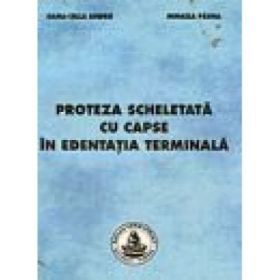 Proteza scheletata cu capse in edentatia terminala - Mihaela Pauna