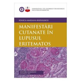 Manifestari cutanate in lupusul eritematos - Ionica-Mariana Radulescu