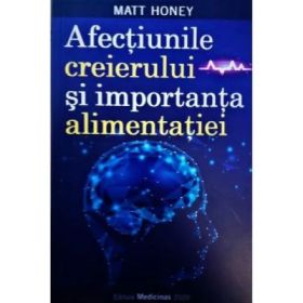 Afectiunile creierului si importanta in alimentatie - Mat Honey
